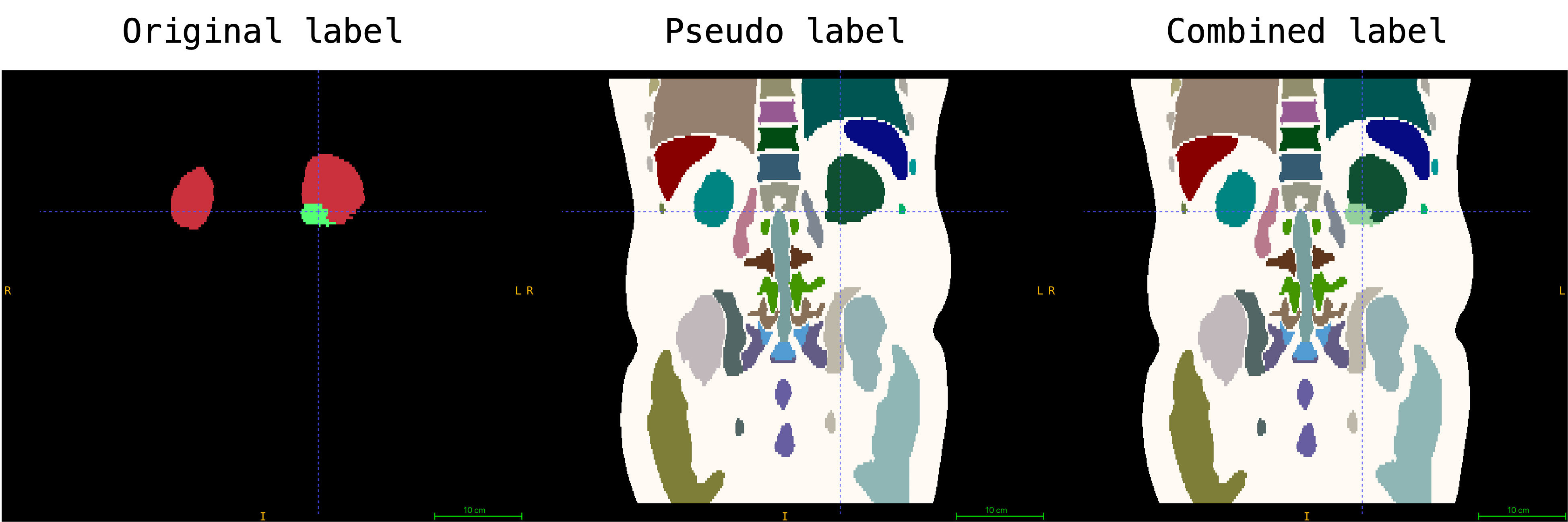 example_combined_mask